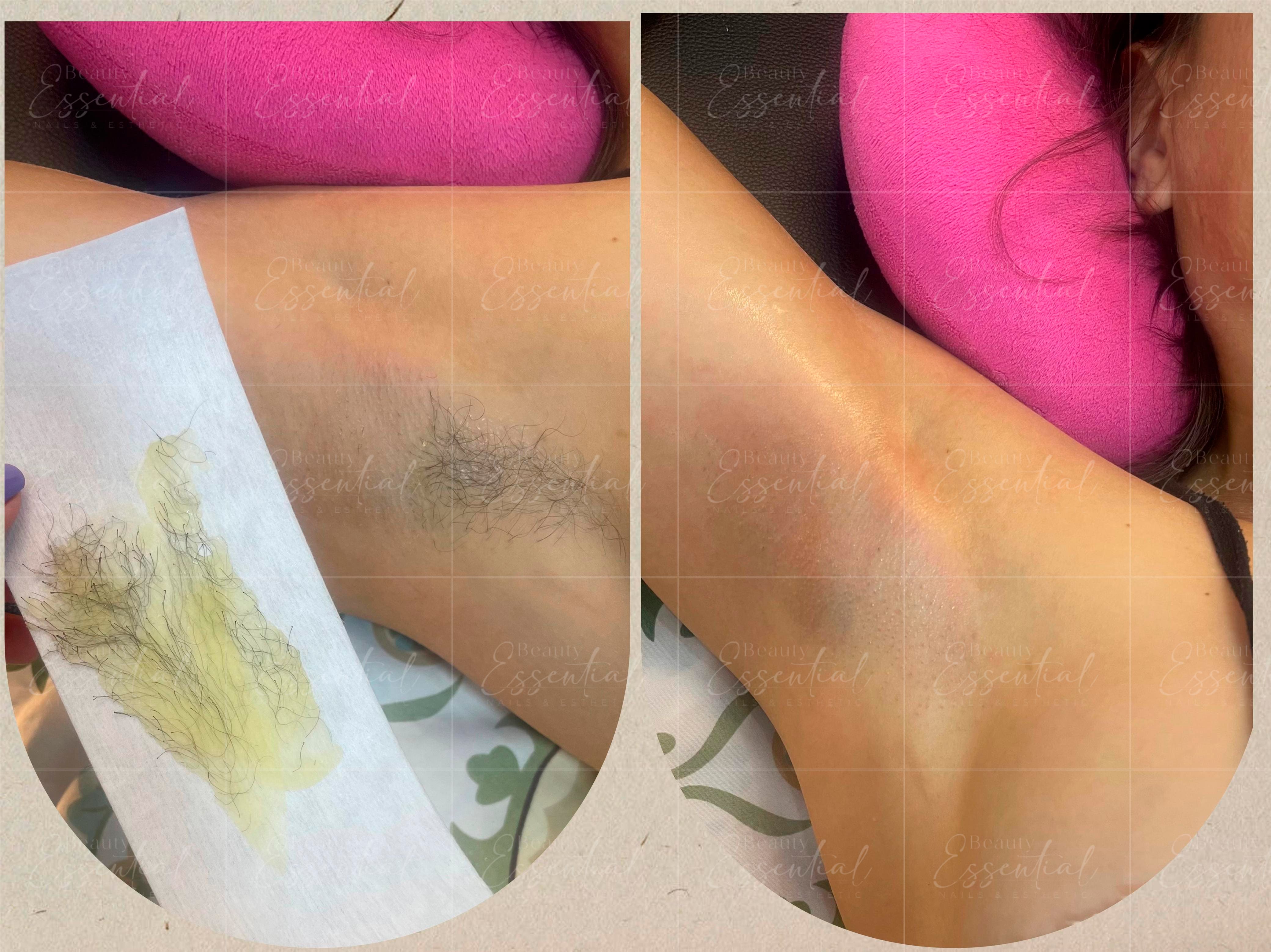 Depilación en Beauty Essential Santo Domingo